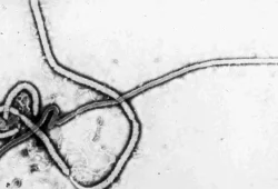 Was man über das Ebolavirus wissen sollte