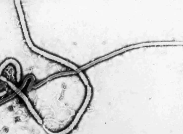 Was man über das Ebolavirus wissen sollte