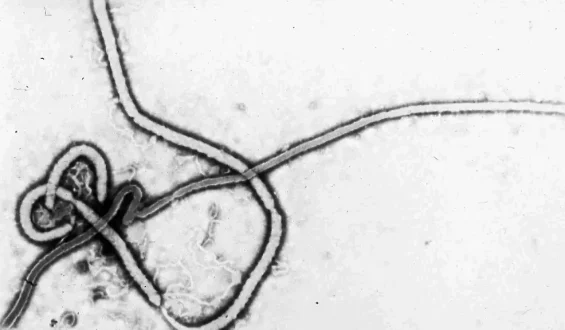 Was man über das Ebolavirus wissen sollte