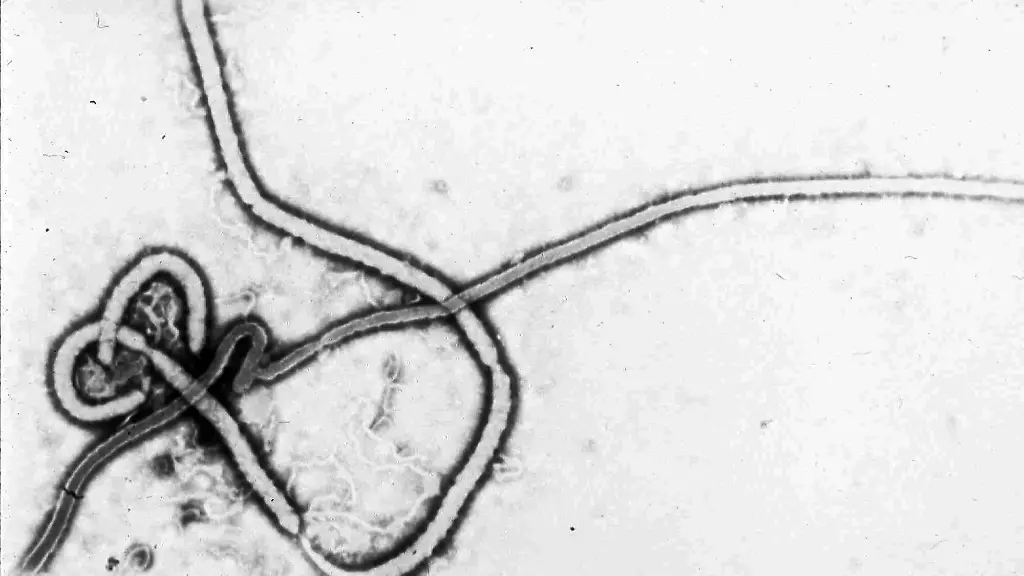 Was man über das Ebolavirus wissen sollte