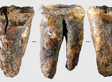 Neandertaler kannten bereits Zahnärzte