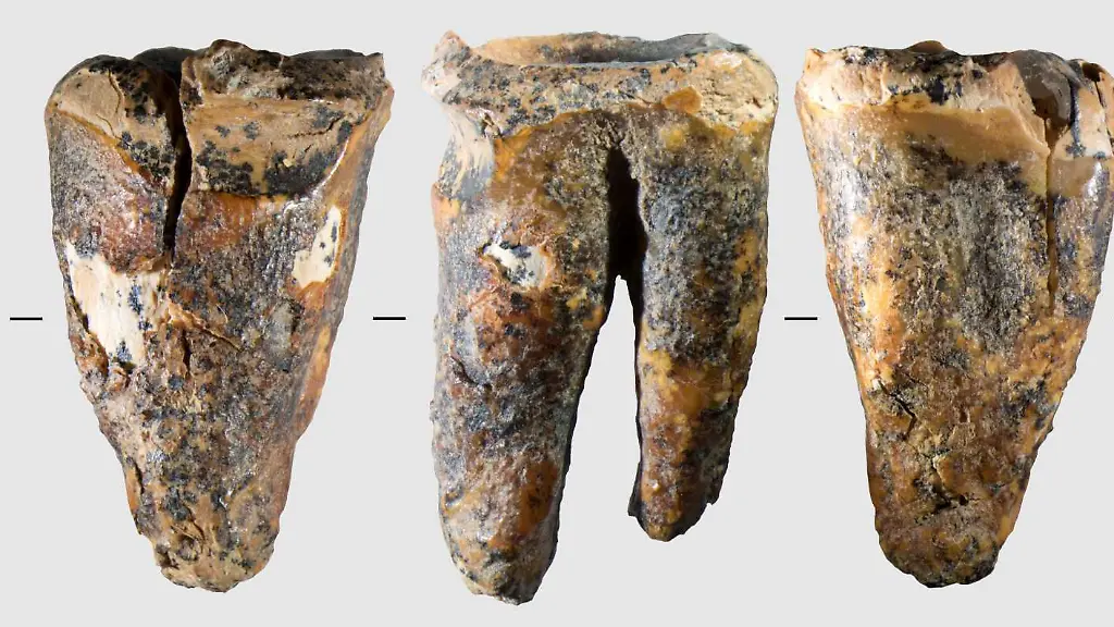Neandertaler kannten bereits Zahnärzte