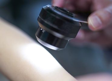 Studie untersucht mRNA-Impfung gegen Hautkrebs
