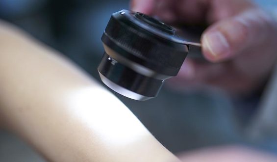 Studie untersucht mRNA-Impfung gegen Hautkrebs