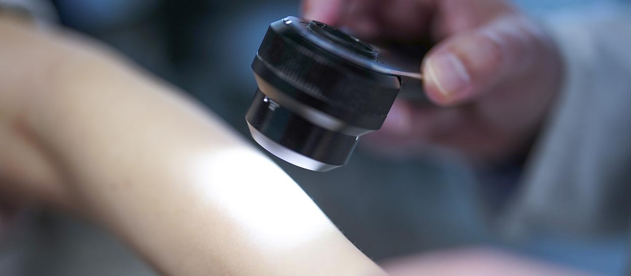 Studie untersucht mRNA-Impfung gegen Hautkrebs