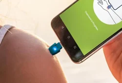 Hilfe gegen Juckreiz: Insektenstichheiler am Prime Day günstig