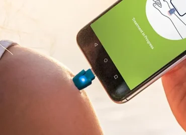 Hilfe gegen Juckreiz: Insektenstichheiler am Prime Day günstig