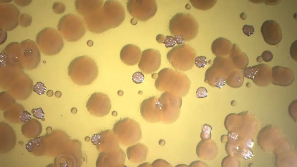 Forscher klären Ursachen für extreme Antibiotika-Resistenzen