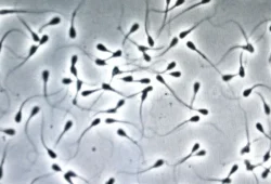 Luftverschmutzung und deren Einfluss auf Spermien-DNA