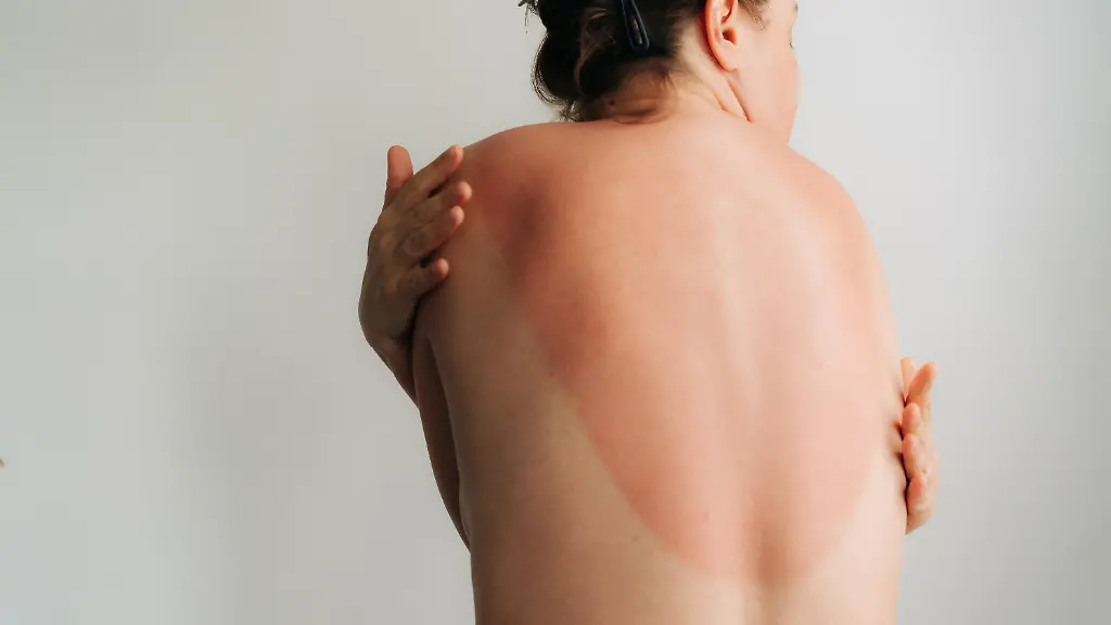 Gefahr von Hautkrebs durch UV-Strahlung