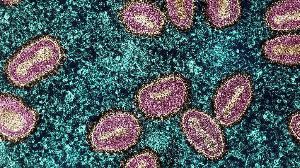 Studie: Spermien fördern Mpox-Infektionen
