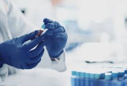 Sepsis: Eine unterschätzte Bedrohung und ihre Langzeitfolgen