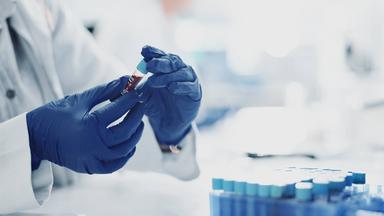 Sepsis: Eine unterschätzte Bedrohung und ihre Langzeitfolgen