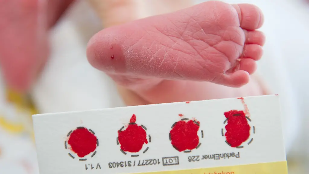 Erfolg des Neugeborenen-Screenings bei der Diagnose von Mukoviszidose in Bayern