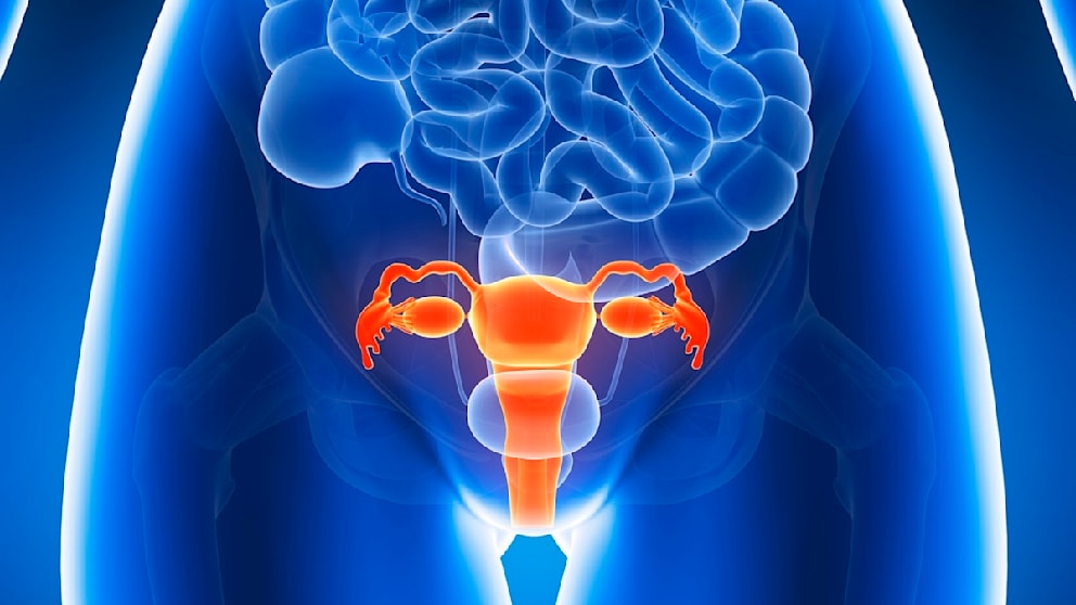 Frauenärztin erklärt Endometriose